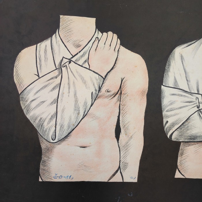 Passa il mouse sull'immagine per ingrandire Immagine dell'articolo Poster Set di 4 poster medici didattici anni 30 n.321
