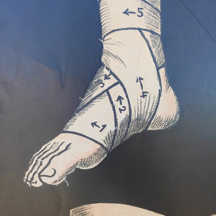 Passa il mouse sull'immagine per ingrandire Immagine dell'articolo Poster Set di 4 poster medici didattici anni 30 n.321